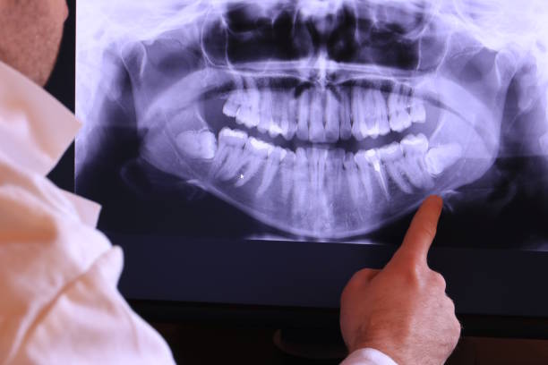 Best Mobile Emergency Dentist in Terre Haute, IN