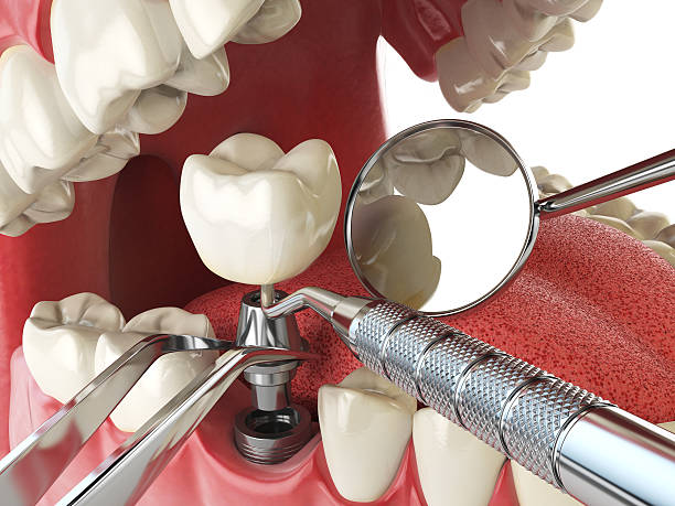 Best Weekend Emergency Dentist in Terre Haute, IN