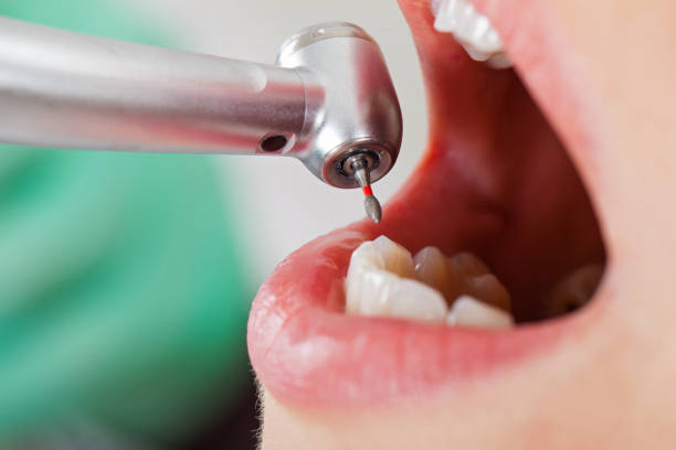 Best Emergency Dental Services for Seniors in Terre Haute, IN